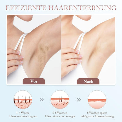 Laser Hair Removal for Women