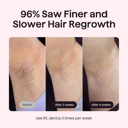Salon-Quality Hair Removal