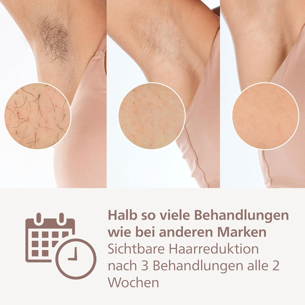 Philips Lumea IPL 9900