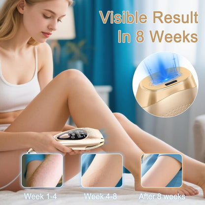 Lifetime Use IPL Hair Removal