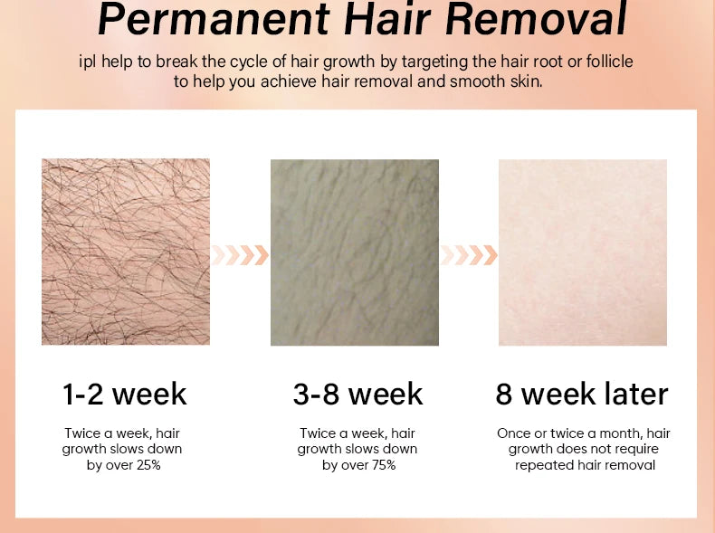Premium 4 in 1 IPL Hair Removal Device