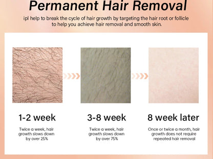 Premium 4 in 1 IPL Hair Removal Device