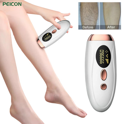 Permanent Hair Removal for Body