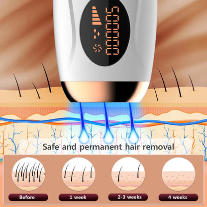Permanent Hair Removal for Body