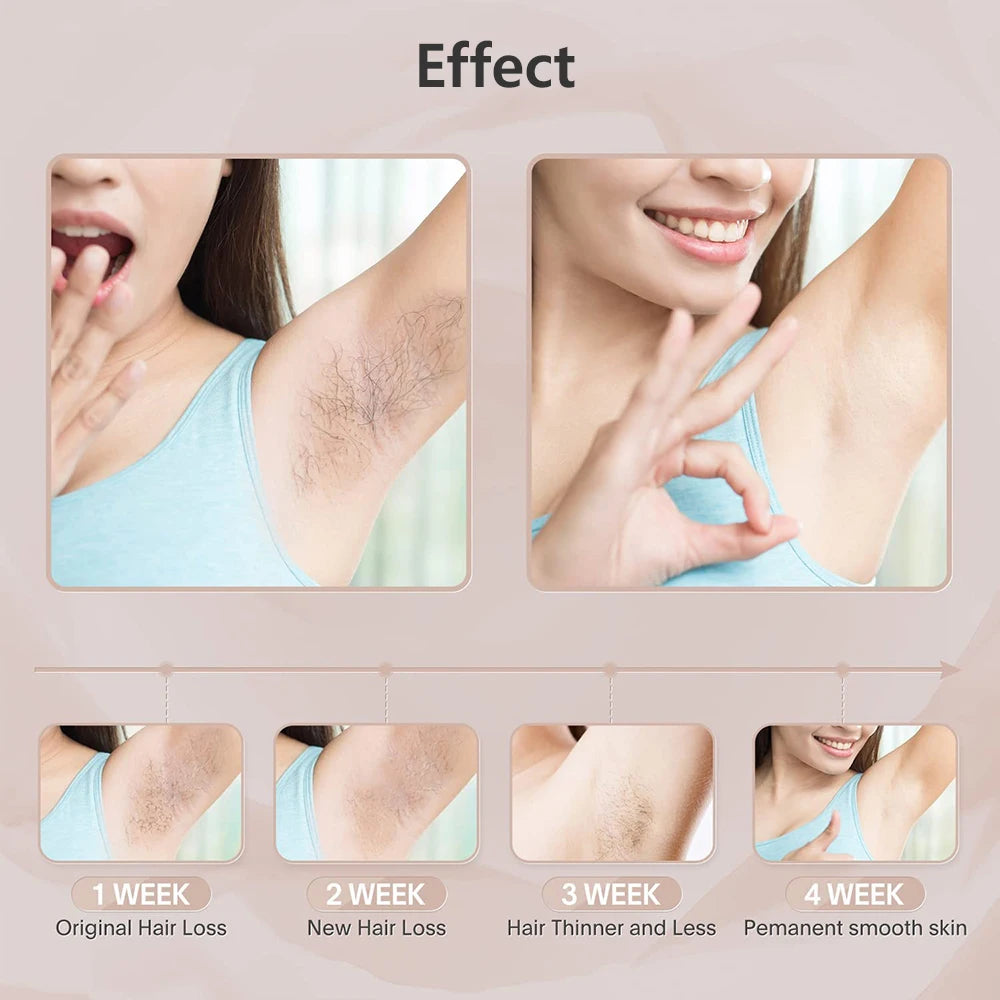 Permanent Hair Removal for Body