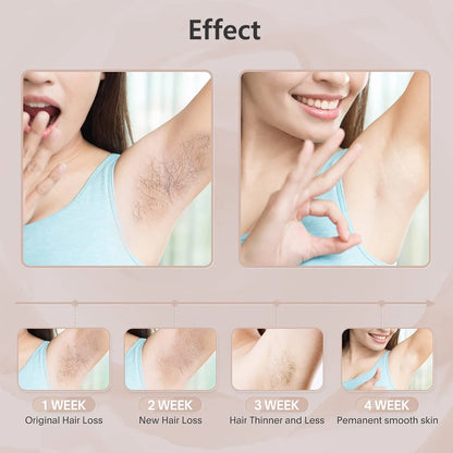 Permanent Hair Removal for Body